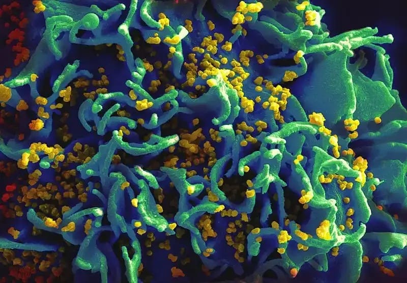 Vacina inédita contra HIV tem resultados promissores em estudo de fase 1