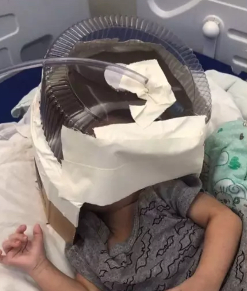 Hospital usa embalagem de bolo como máscara de oxigênio para bebê de 3 meses no RN
