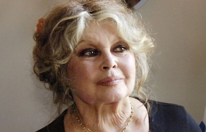 Brigitte Bardot, de 91 anos, é internada em estado grave e passa por cirurgia na França
