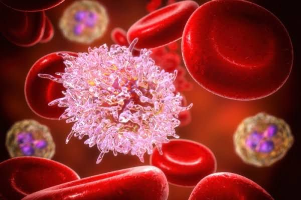 Sinais de alerta: Saiba como identificar os primeiros sintomas da leucemia