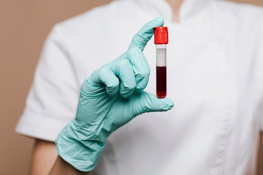 O futuro do diagnóstico: Como o novo exame de sangue antecipa o avanço do câncer