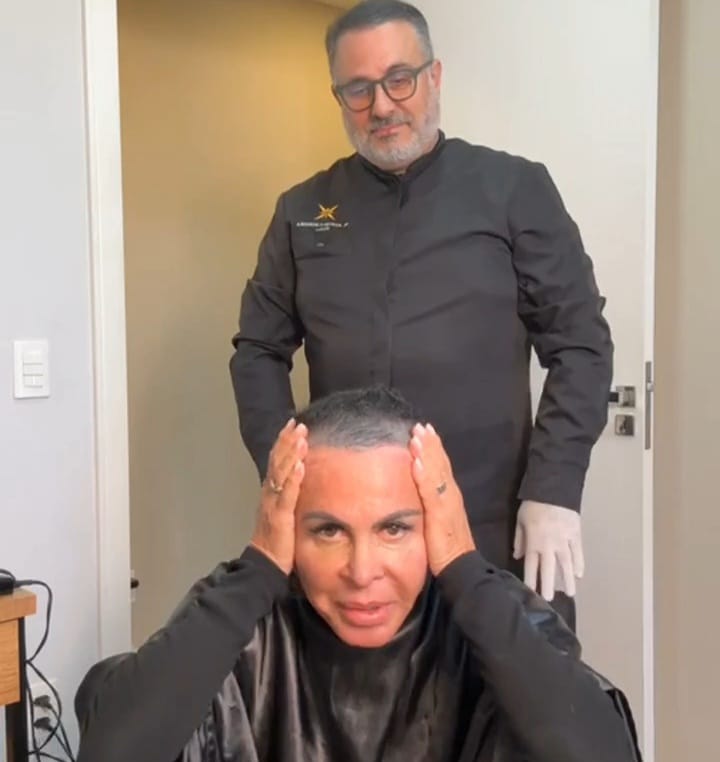 Gretchen raspa a cabeça antes de transplante capilar e fala sobre alopecia